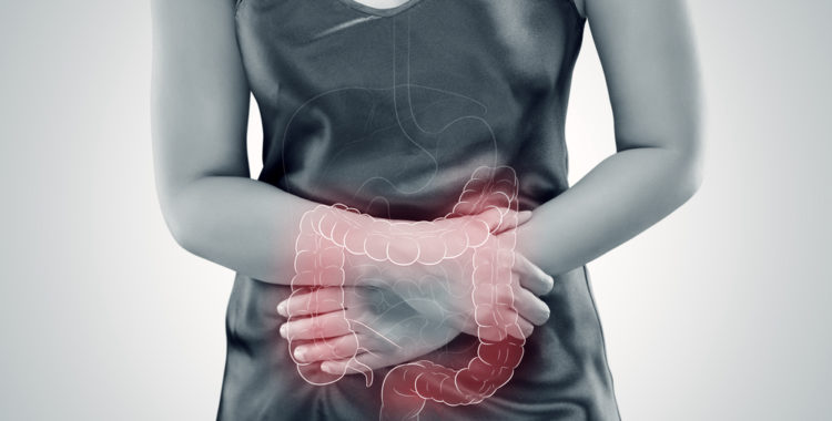 What You Need to Know About Living With Ulcerative Colitis
