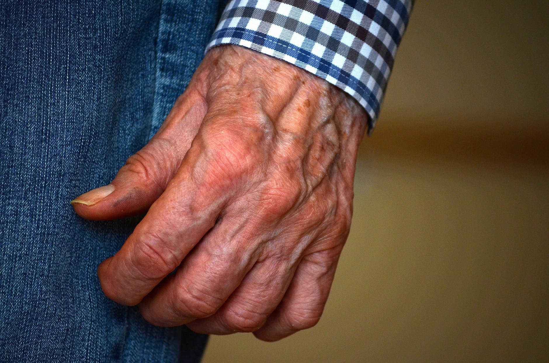 a person with arthritis