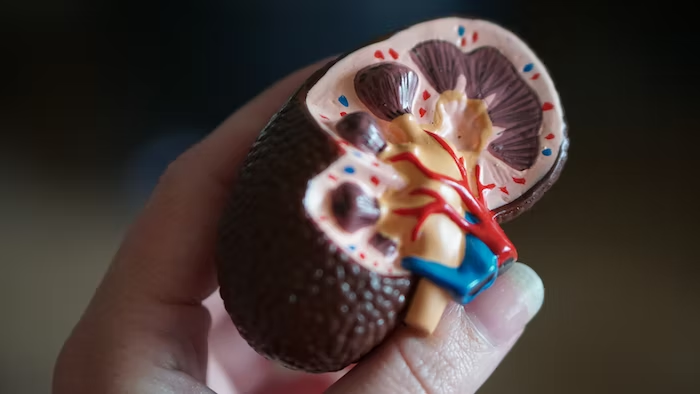 a person holding a 3D model of a kidney
